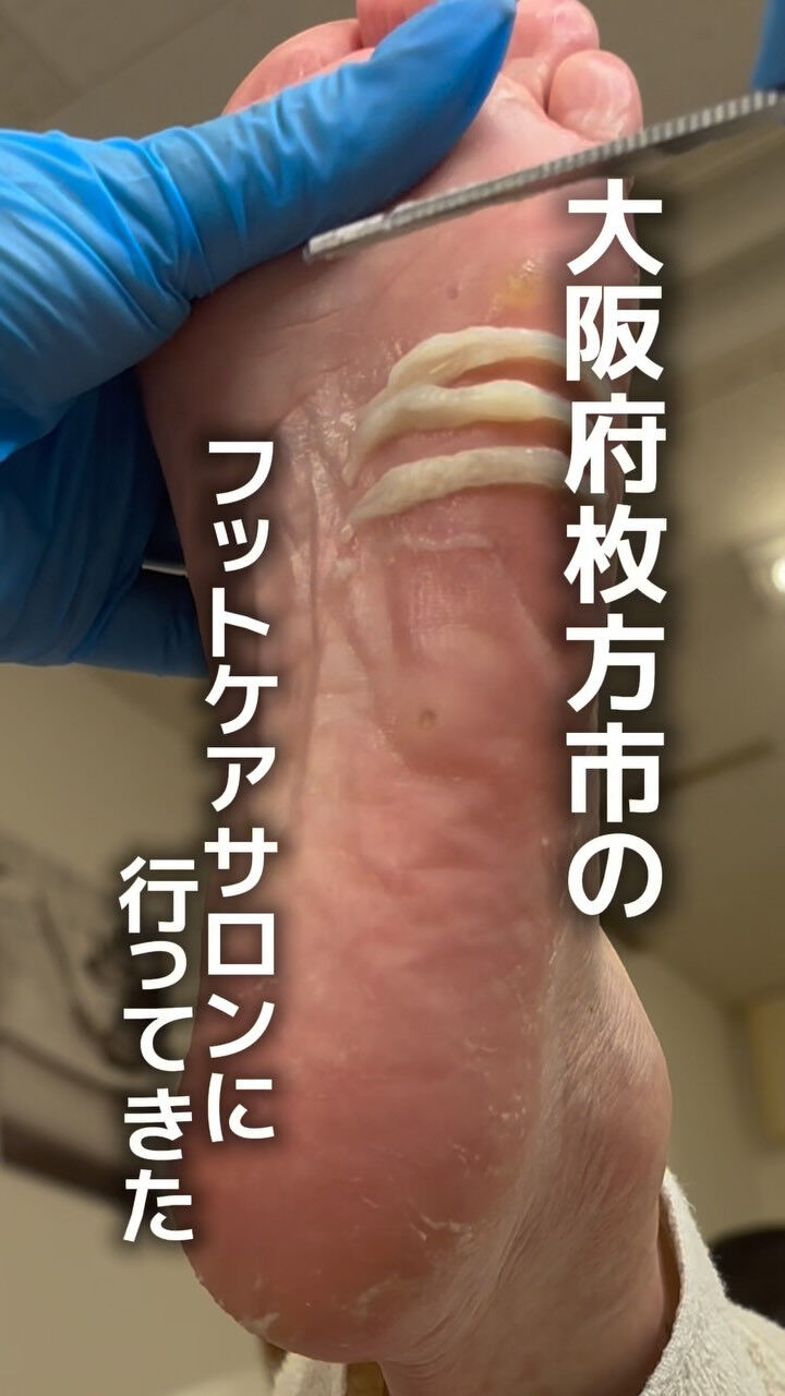 韓国式足裏角質ケア　Stellia　です