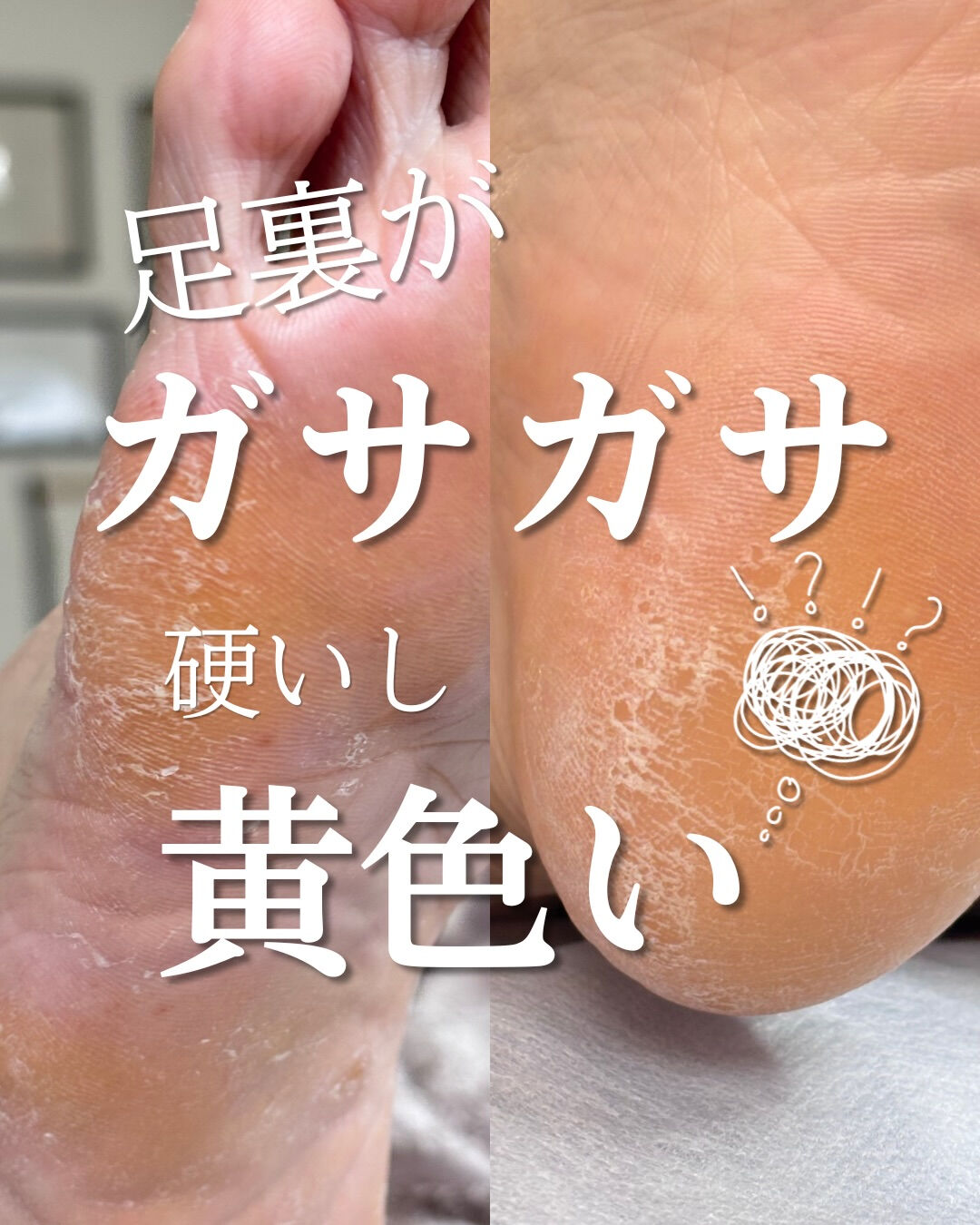 韓国式足裏角質ケア　Stellia　です