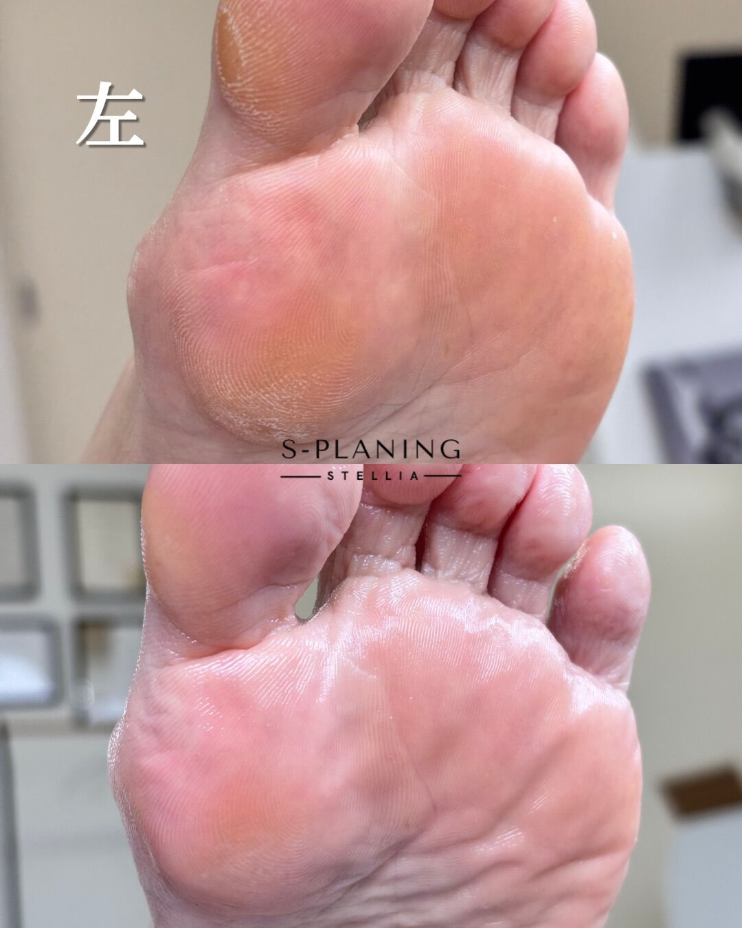 韓国式足裏角質ケア　Stellia　です
